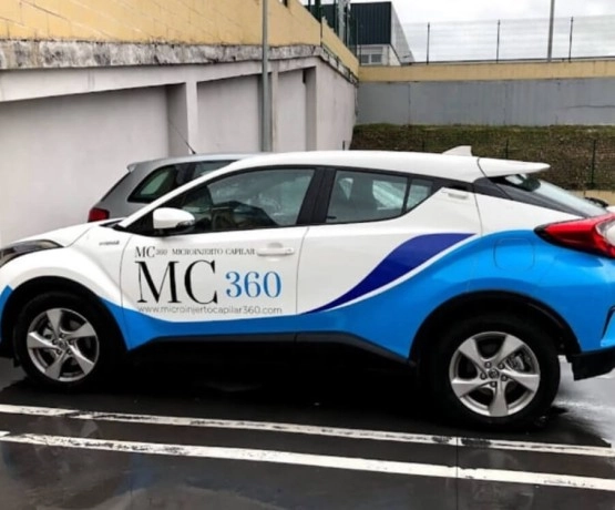 Microinjerto Capilar 360